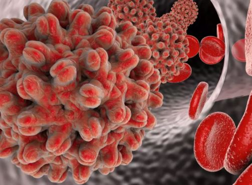 Guérir Hépatite B Avec Plantes