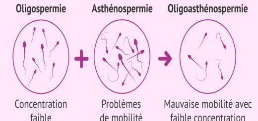 Guérir L'Asthénospermie Naturellement