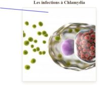 Infection de Chlamydia Traitement Naturel