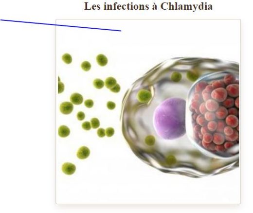 Guérir Naturellement La Chlamydia