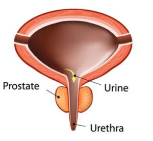 Traitement naturel Cancer de la Prostate