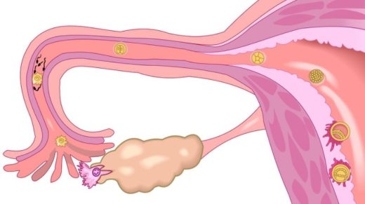 Trompes de Fallope Bouchées: Recette Simple Pour Trompes Bouchées