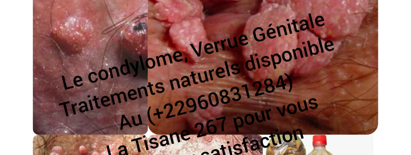 Condylomes Verrues Traitement Naturel