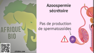 Azoospermie Symptômes Traitement Naturel - Azoospermie sécréroire