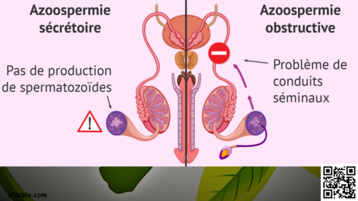 Guérir L'Azoospermie Avec Les Plantes