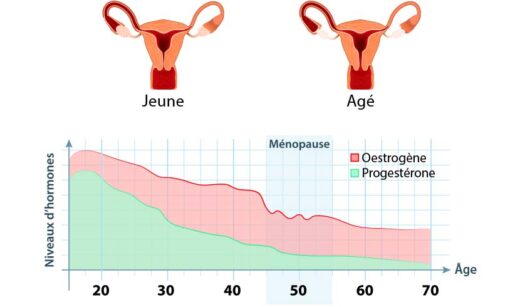 Ménopause précoce traitement naturel