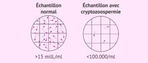 Cryptozoospermie Conséquences et Traitement Naturel