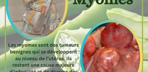 Éliminer Les Myomes Naturellement