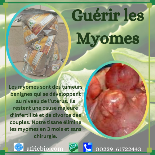 Guérir Naturellement Les Fibromes