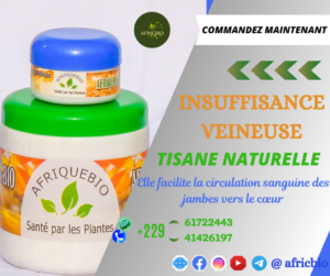 Guérir L'Insuffisance Veineuse Naturellement