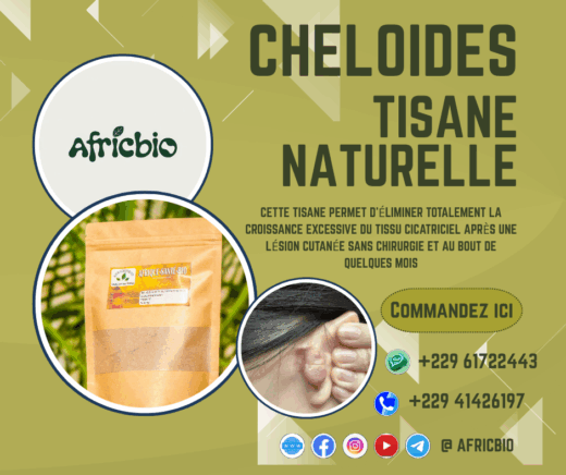 Guérir Les Chéloïdes Naturellement